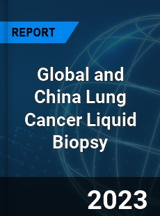 Global and China Lung Cancer Liquid Biopsy Industry