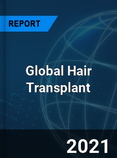 Global Hair Transplant Market