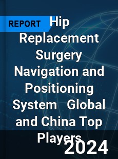 Hip Replacement Surgery Navigation and Positioning System Global and China Top Players Market