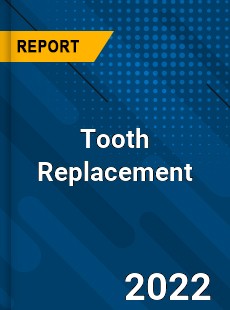 Tooth Replacement Market